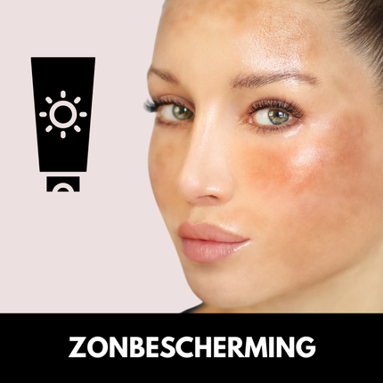 pigment zonbescherming