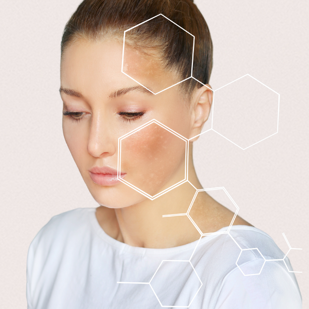 <strong>Skin Quiz</strong>