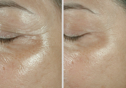 Elastiderm Firming Eye CREAM - Obagi Medical